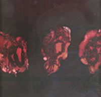 Deathspell: Kenose